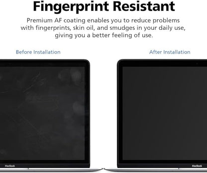 Magnetic Privacy Screen Protector for MacBook Pro 14 Inch (2024 M4,2023 M3 2022 M2 2021 M1), Removable Anti Glare Anti Blue Light Anti Spy Screen Filter