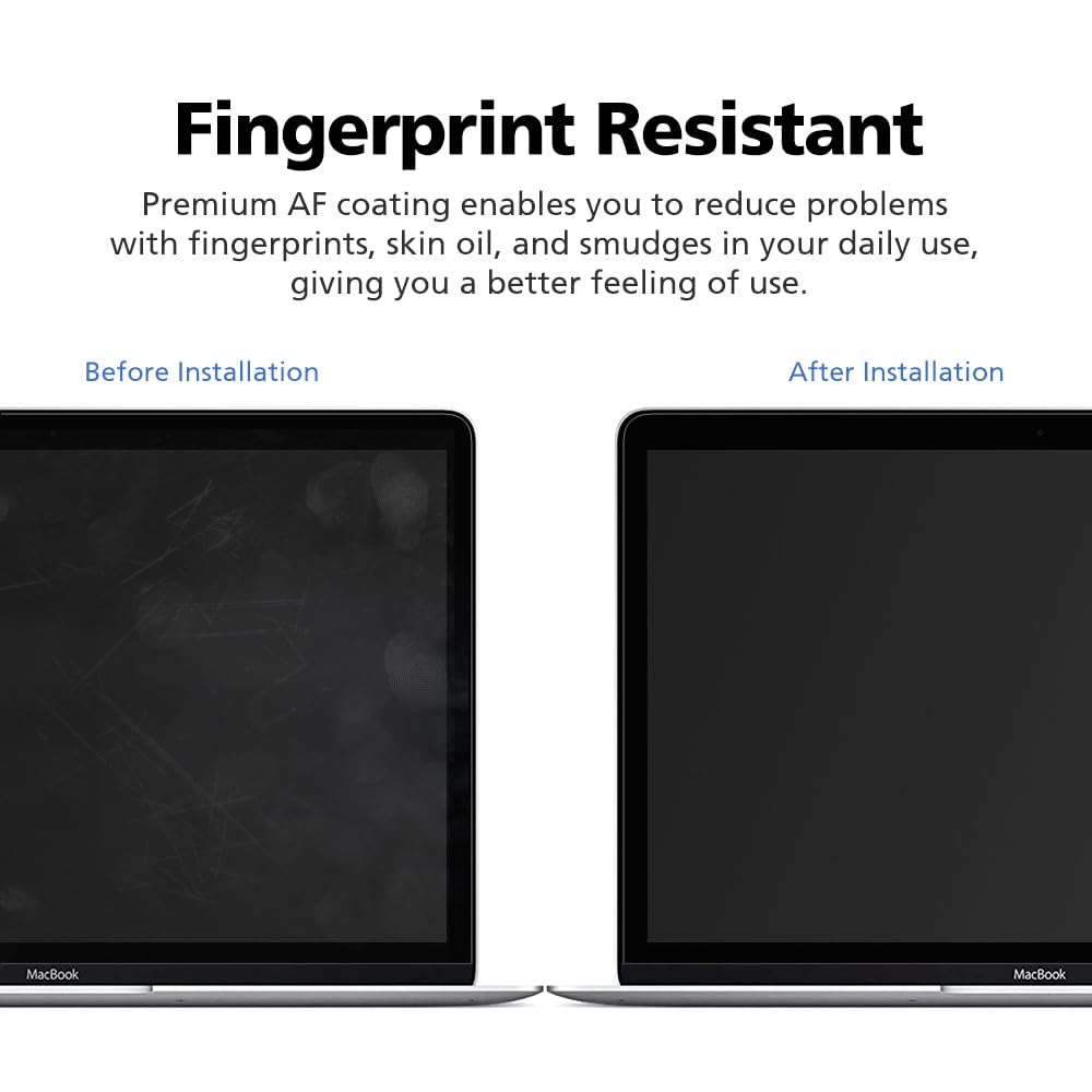 Diacube Magnetic Privacy Screen Protector for MacBook Pro 14 inch M5/M4/M3/M2/M1 (2025~2021), Removable Anti Glare Anti Blue Light Anti Spy Screen Filter