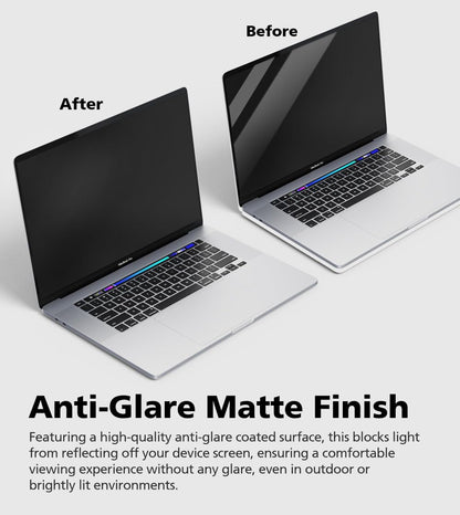 Diacube Magnetic Privacy Screen Protector for MacBook Pro 15" (2017-2019), Removable Anti Glare Anti Blue Light Anti Spy Screen Filter