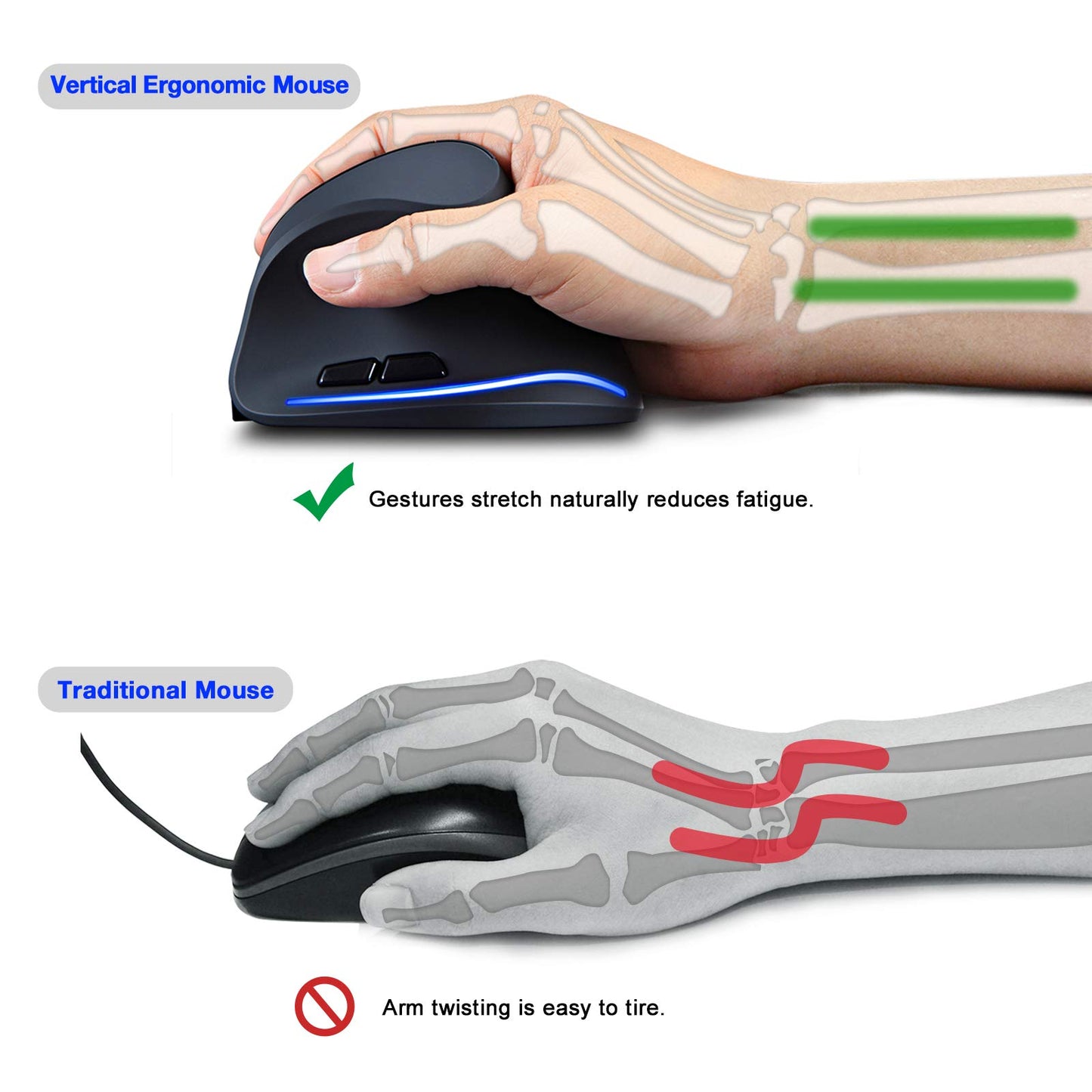 TRELC Ergonomic Mouse, 2.4G Wireless Vertical Optical Mouse with Adjustable Sensitivity (1000/1600/2400 DPI), 6 Buttons for PC, Desktop, Laptop, Notebook (Black)